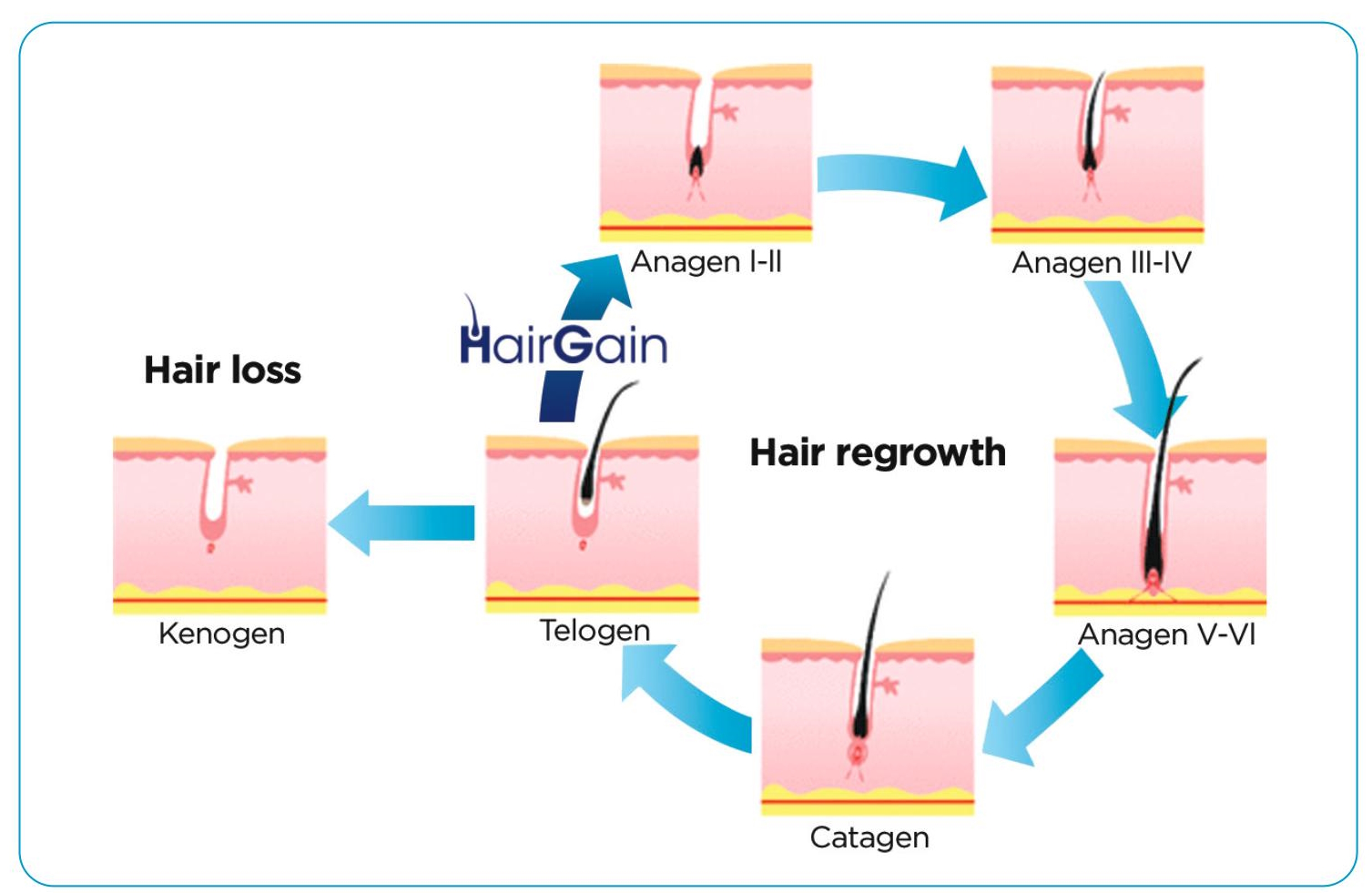 hairgain